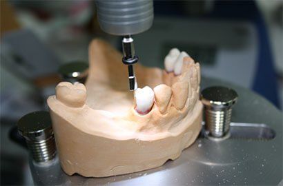 зъбна ортопедия