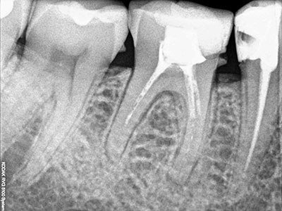 зъболекар проверка на дефекта