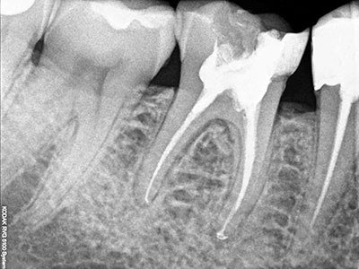 зъбна проверка след манипулацията